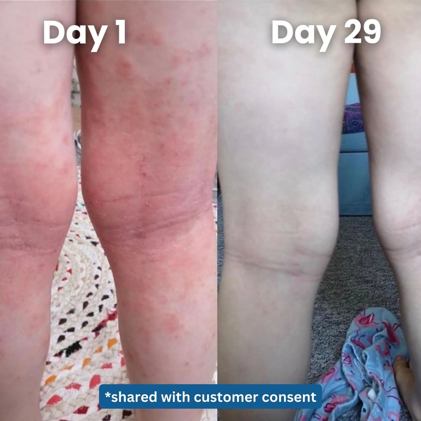 Natural Ocean Eczema Cream