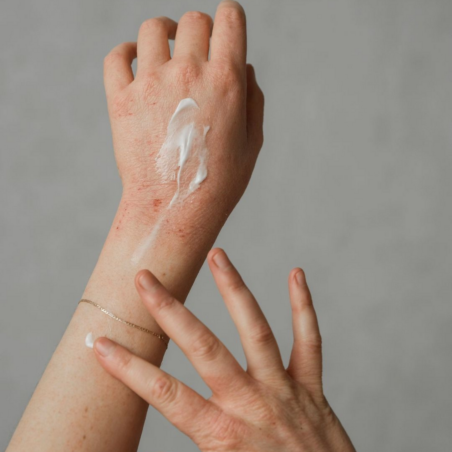 Natural Ocean Eczema Cream