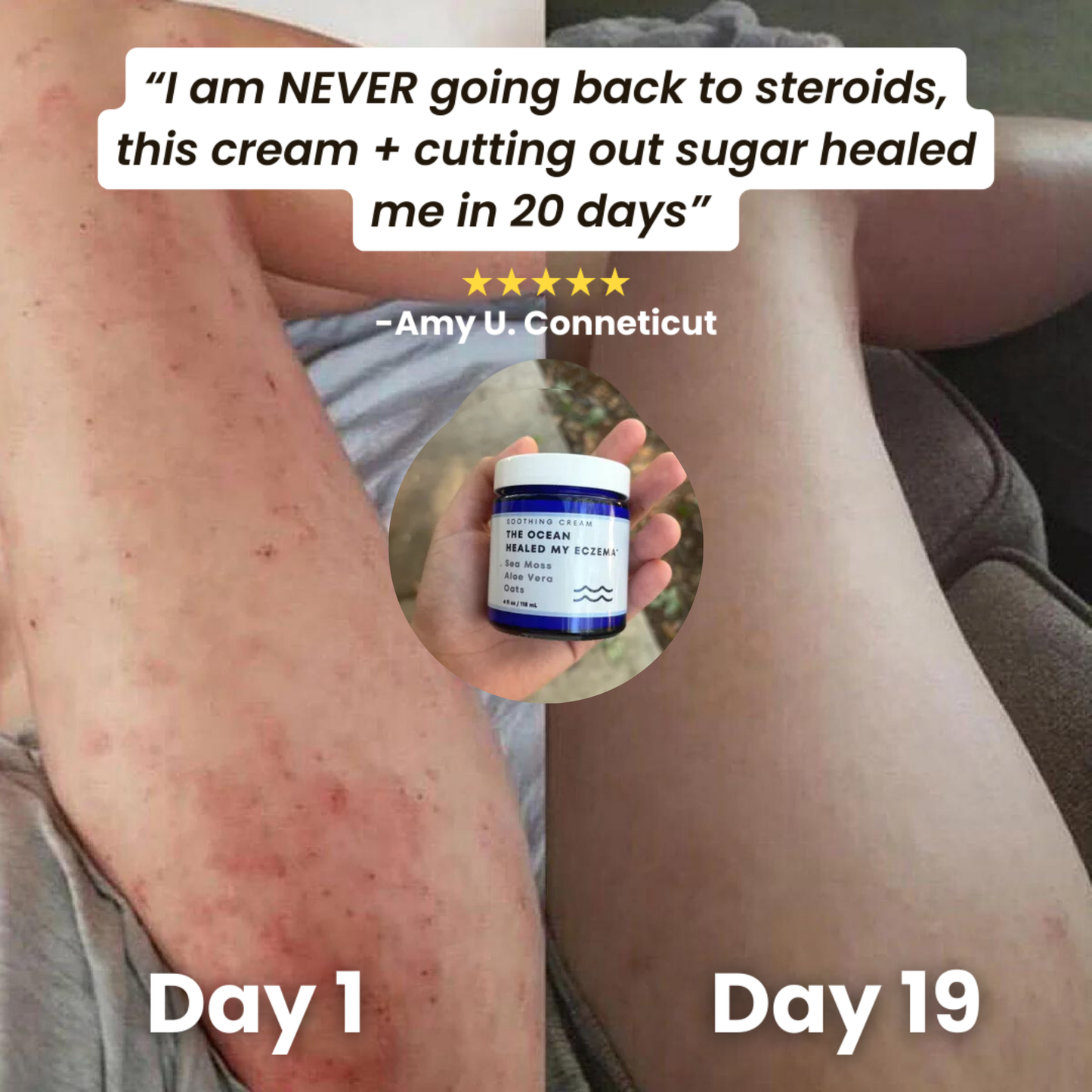 Natural Ocean Eczema Cream