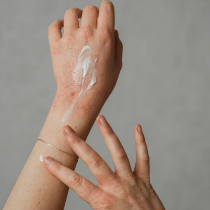 Natural Ocean Eczema Cream